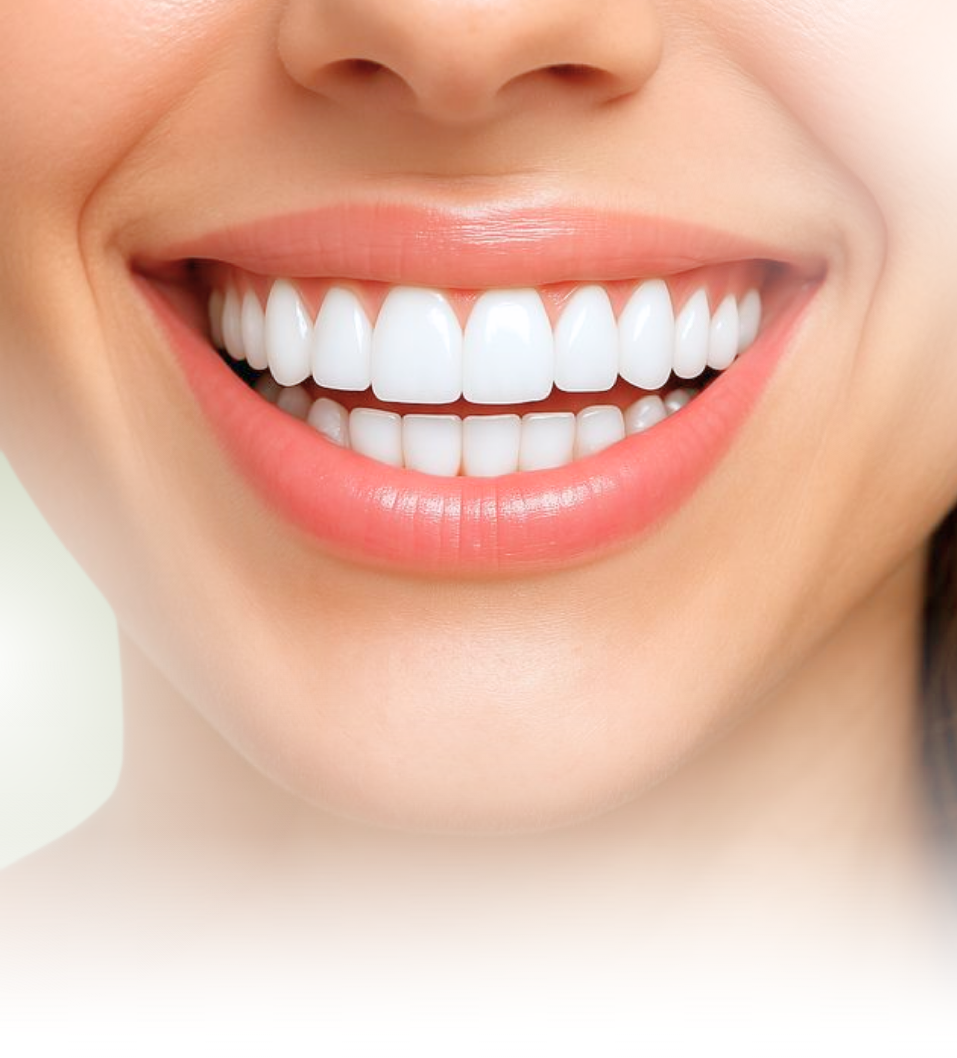 Veneer
