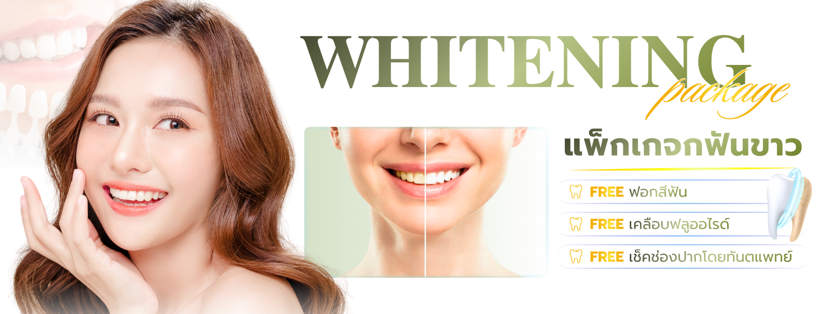 Whitening (2)